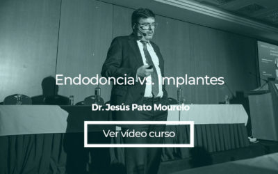 Endodoncia vs. Implantes